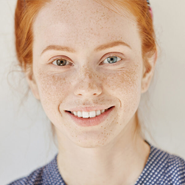 Taches & Teint Inégal